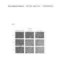 PHARMACEUTICAL COMPOSITION FOR TREATING CANCER USING CARBONATE APATITE     NANOPARTICLES diagram and image