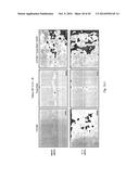 PHARMACEUTICAL COMPOSITION FOR TREATING CANCER USING CARBONATE APATITE     NANOPARTICLES diagram and image