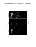 PHARMACEUTICAL COMPOSITION FOR TREATING CANCER USING CARBONATE APATITE     NANOPARTICLES diagram and image