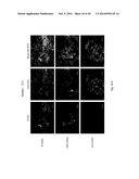 PHARMACEUTICAL COMPOSITION FOR TREATING CANCER USING CARBONATE APATITE     NANOPARTICLES diagram and image