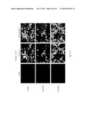 PHARMACEUTICAL COMPOSITION FOR TREATING CANCER USING CARBONATE APATITE     NANOPARTICLES diagram and image