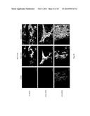 PHARMACEUTICAL COMPOSITION FOR TREATING CANCER USING CARBONATE APATITE     NANOPARTICLES diagram and image