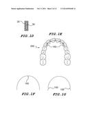 Orthodontic Wire Alignment System and Method diagram and image