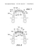 Orthodontic Wire Alignment System and Method diagram and image