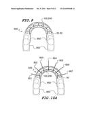 Orthodontic Wire Alignment System and Method diagram and image