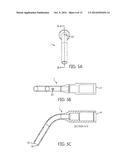 ULTRASONIC TIP ASSEMBLY diagram and image