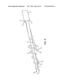 ULTRASONIC TIP ASSEMBLY diagram and image