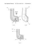 DENTAL TREATMENT APPARATUS AND METHOD diagram and image