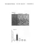 Methods Of Treating Acute Kidney Injury With Retinoic Acid diagram and image