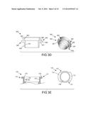 BLOOD FLOW SYSTEM WITH OPERATOR ATTACHABLE COMPONENTS diagram and image