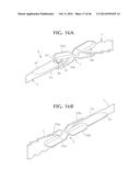 SELF-ANCHORING SLING AND INTRODUCER SYSTEM diagram and image