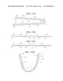 SELF-ANCHORING SLING AND INTRODUCER SYSTEM diagram and image