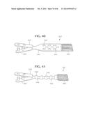 SELF-ANCHORING SLING AND INTRODUCER SYSTEM diagram and image