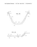 SELF-ANCHORING SLING AND INTRODUCER SYSTEM diagram and image