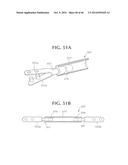 SELF-ANCHORING SLING AND INTRODUCER SYSTEM diagram and image