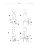 SYSTEM FOR MANAGEMENT AND PREVENTION OF VENOUS POOLING diagram and image