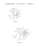 APPARATUS AND METHODS FOR ACCESSING THE LYMPHATIC SYSTEM diagram and image