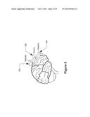 FUNCTIONAL NEAR-INFRARED SPECTROSCOPY AS A MONITOR FOR DEPTH OF ANESTHESIA diagram and image