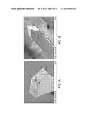 Non-Invasive Segmentable Three-Dimensional Microelectrode Array Patch For     Neurophysiological Diagnostics And Therapeutic Stimulation diagram and image