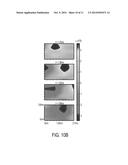 Non-Invasive Segmentable Three-Dimensional Microelectrode Array Patch For     Neurophysiological Diagnostics And Therapeutic Stimulation diagram and image