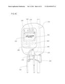 Device to Aid in Diagnosing Infiltration or Extravasation in Animalia     Tissue diagram and image