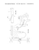 Device to Aid in Diagnosing Infiltration or Extravasation in Animalia     Tissue diagram and image