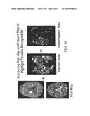 Tissue Disorder Imaging Analysis diagram and image