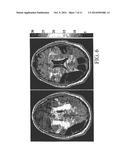 Tissue Disorder Imaging Analysis diagram and image