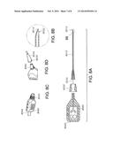 NEEDLE GUIDANCE SYSTEM diagram and image