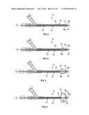 APPARATUS AND METHODS FOR TREATING OBSTRUCTIONS WITHIN BODY LUMENS diagram and image