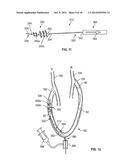 APPARATUS AND METHODS FOR TREATING OBSTRUCTIONS WITHIN BODY LUMENS diagram and image