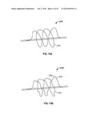 APPARATUS AND METHODS FOR TREATING OBSTRUCTIONS WITHIN BODY LUMENS diagram and image