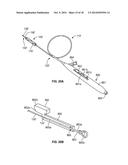 APPARATUS AND METHODS FOR TREATING OBSTRUCTIONS WITHIN BODY LUMENS diagram and image