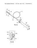 APPARATUS AND METHODS FOR TREATING OBSTRUCTIONS WITHIN BODY LUMENS diagram and image