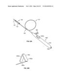 APPARATUS AND METHODS FOR TREATING OBSTRUCTIONS WITHIN BODY LUMENS diagram and image