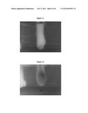 DELIVERY OF MATERIALS INTO MARGINS OF TISSUE CAVITIES diagram and image