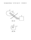 SYSTEM AND METHOD FOR ENERGY DELIVERY TO A TISSUE USING AN ELECTRODE ARRAY diagram and image