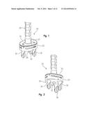 Peripheral Peg Drill Component diagram and image