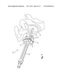 Peripheral Peg Drill Component diagram and image