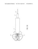 SUTURING DEVICES AND METHODS FOR SUTURING AN ANATOMIC VALVE diagram and image