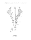 SUTURING DEVICES AND METHODS FOR SUTURING AN ANATOMIC VALVE diagram and image