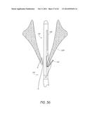 SUTURING DEVICES AND METHODS FOR SUTURING AN ANATOMIC VALVE diagram and image