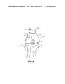 DEVICES AND METHODS FOR TREATING DEFECTS IN THE TISSUE OF A LIVING BEING diagram and image