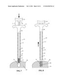 DEVICES AND METHODS FOR TREATING DEFECTS IN THE TISSUE OF A LIVING BEING diagram and image