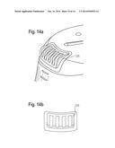 PRETREATMENT CUP FOR TREATING DURABLE AND DELICATE FABRICS diagram and image