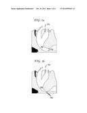 MAGNETIC IMPLANTS AND METHODS FOR TREATING AN OROPHARYNGEAL CONDITION diagram and image