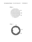 MAGNETIC IMPLANTS AND METHODS FOR TREATING AN OROPHARYNGEAL CONDITION diagram and image