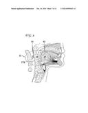 MAGNETIC IMPLANTS AND METHODS FOR TREATING AN OROPHARYNGEAL CONDITION diagram and image