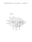 MAGNETIC IMPLANTS AND METHODS FOR TREATING AN OROPHARYNGEAL CONDITION diagram and image