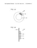 MAGNETIC IMPLANTS AND METHODS FOR TREATING AN OROPHARYNGEAL CONDITION diagram and image